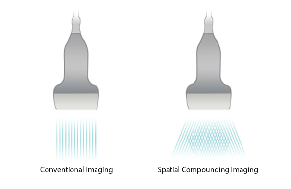 Spatial_Compounding_Technology